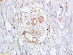 BRCA2 Antibody in Immunohistochemistry (Paraffin) (IHC (P))