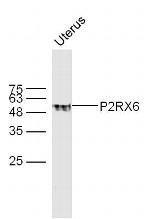 P2RX6 Antibody in Western Blot (WB)