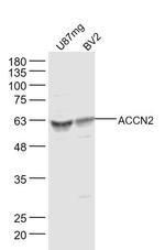 ACCN2 Antibody in Western Blot (WB)