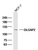 SAPAP2/DLGAP2 Antibody in Western Blot (WB)