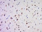 SAPAP4/DLGAP4 Antibody in Immunohistochemistry (Paraffin) (IHC (P))