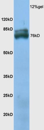 TXLNB Antibody in Western Blot (WB)