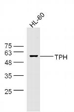 Tryptophan 5-hydroxylase 1, Tryptophan 5-hydroxylase 2 Antibody in Western Blot (WB)