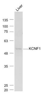 KCNF1 Antibody in Western Blot (WB)