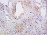 Phospho-CXCR4 (Ser339) Antibody in Immunohistochemistry (Paraffin) (IHC (P))