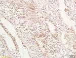 GPA33 Antibody in Immunohistochemistry (Paraffin) (IHC (P))