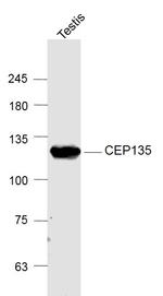 CEP135 Antibody in Western Blot (WB)