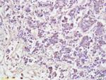 AATF Antibody in Immunohistochemistry (Paraffin) (IHC (P))