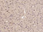 ABCG1 Antibody in Immunohistochemistry (Paraffin) (IHC (P))