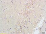 GABA A Receptor alpha 1 Antibody in Immunohistochemistry (Paraffin) (IHC (P))