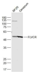 FLVCR Antibody in Western Blot (WB)