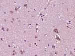 YKL39/CHI3L2 Antibody in Immunohistochemistry (Paraffin) (IHC (P))