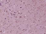 K7 Antibody in Immunohistochemistry (Paraffin) (IHC (P))