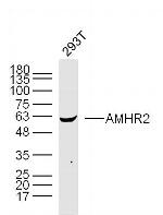 AMHR2 Antibody in Western Blot (WB)