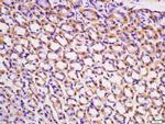 ACVR2B/ACTR2B Antibody in Immunohistochemistry (Paraffin) (IHC (P))