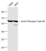 ACVR2B/ACTR2B Antibody in Western Blot (WB)