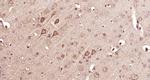 14-3-3 beta Antibody in Immunohistochemistry (Paraffin) (IHC (P))