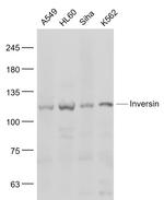 Inversin Antibody in Western Blot (WB)