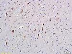 mGluR5 Antibody in Immunohistochemistry (Paraffin) (IHC (P))