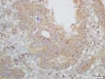 ARPC2/p34-ARC Antibody in Immunohistochemistry (Paraffin) (IHC (P))