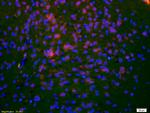 DCLREC1C/Artemis Antibody in Immunohistochemistry (Paraffin) (IHC (P))