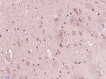 B7-H6 Antibody in Immunohistochemistry (Paraffin) (IHC (P))