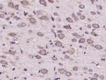 FGF5 Antibody in Immunohistochemistry (Paraffin) (IHC (P))