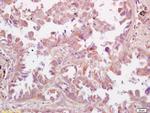 RSV Antibody in Immunohistochemistry (Paraffin) (IHC (P))