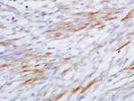 CCL20/MIP3 alpha Antibody in Immunohistochemistry (Paraffin) (IHC (P))