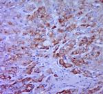 CCL20/MIP3 alpha Antibody in Immunohistochemistry (Paraffin) (IHC (P))