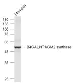 B4GALNT1/GM2 synthase Antibody in Western Blot (WB)