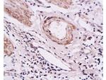 E-Selectin/CD62E Antibody in Immunohistochemistry (Paraffin) (IHC (P))