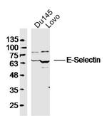 E-Selectin/CD62E Antibody in Western Blot (WB)