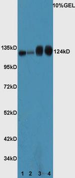 ASPP2/p53BP2 Antibody in Western Blot (WB)