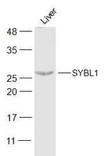 SYBL1 Antibody in Western Blot (WB)