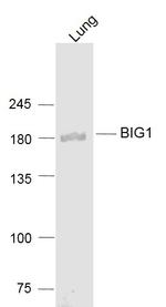 BIG1/ARFGEF1 Antibody in Western Blot (WB)