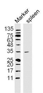 NFKBIA/IKB alpha Antibody in Western Blot (WB)