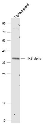 NFKBIA/IKB alpha Antibody in Western Blot (WB)