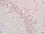 Aromatase Antibody in Immunohistochemistry (Paraffin) (IHC (P))