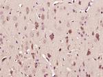 GABA B Receptor 2 Antibody in Immunohistochemistry (Paraffin) (IHC (P))