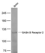 GABA B Receptor 2 Antibody in Western Blot (WB)