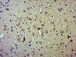 CSK Antibody in Immunohistochemistry (Paraffin) (IHC (P))