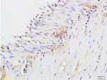 CD28 Antibody in Immunohistochemistry (Paraffin) (IHC (P))