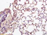 CD28 Antibody in Immunohistochemistry (Paraffin) (IHC (P))