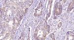 CD28 Antibody in Immunohistochemistry (Paraffin) (IHC (P))