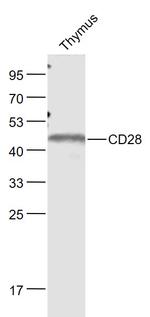 CD28 Antibody in Western Blot (WB)