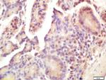 Smac/DIABLO Antibody in Immunohistochemistry (Paraffin) (IHC (P))