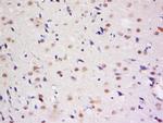 Dymeclin Antibody in Immunohistochemistry (Paraffin) (IHC (P))