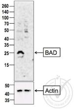 Bad Antibody in Western Blot (WB)