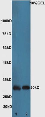 Bad Antibody in Western Blot (WB)